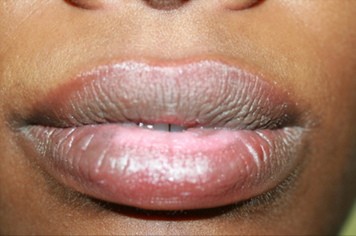 lips